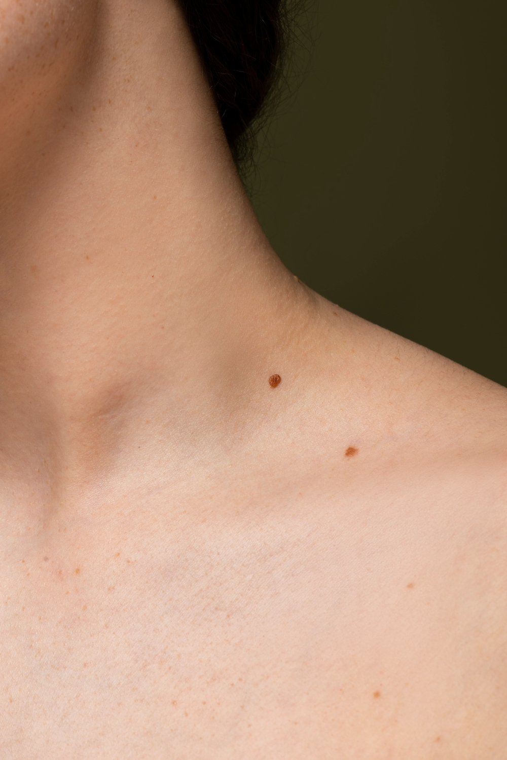 side-view-skin-texture-with-moles